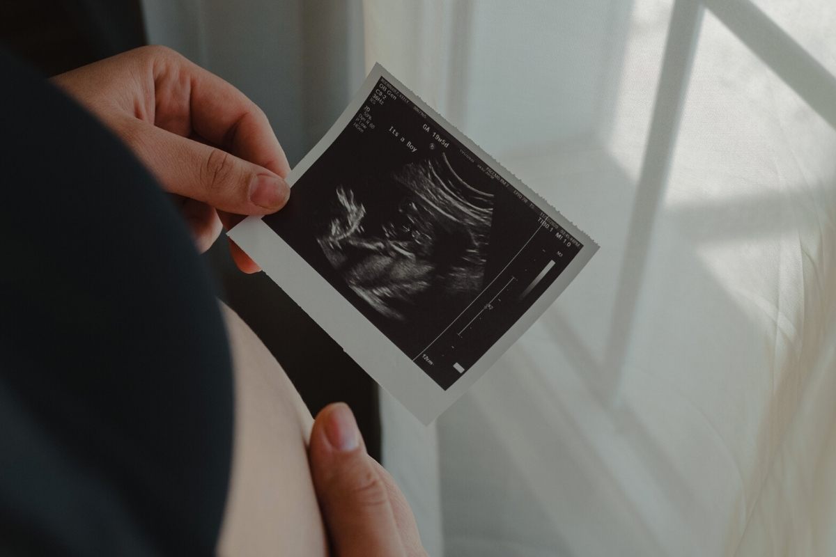 Pregnant woman looking at baby ecography.